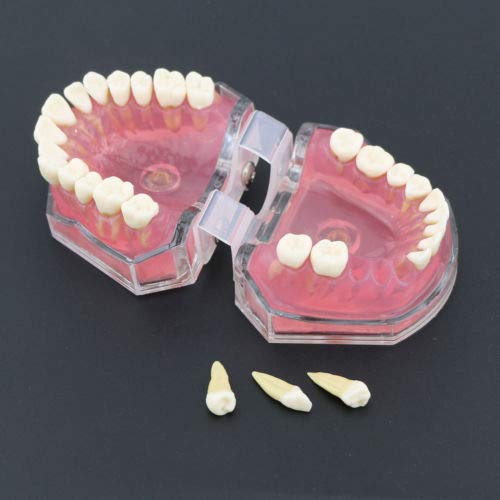 Kadxyan Dental Standard Model with Removable Teeth Dental Study Teach Teeth Model