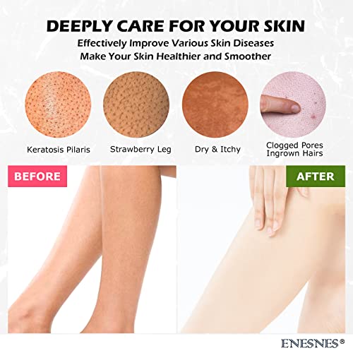 Thickened-Exfoliating-GloveENESNES-2PCS-Exfoliating-Body-Scrubber-for-ShowerKorean-Exfoliating-MittSpecial-Dead-Skin-Remover-and-Exfoliator-for-BodyGreat-for-Spray-Tan-Removal-or-Keratosis-Pilaris