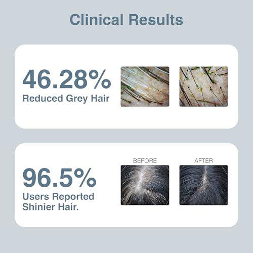 Image of ThriveCo Anti Grey Hair Prime Serum | Naturally Reverse Greying Hair & Beard | Advanced Clinically Proven Treatment | With Arcedin + Arcolys + Biotin | Light Weight, Non-Sticky | Men & Women |30 ml