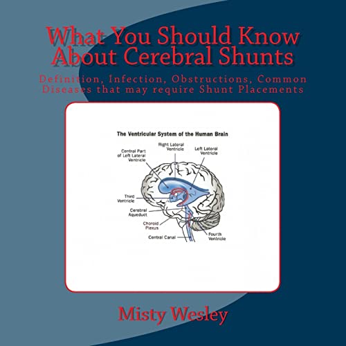 What You Should Know About Cerebral Shunts: Definition, Infection, Obstructions,