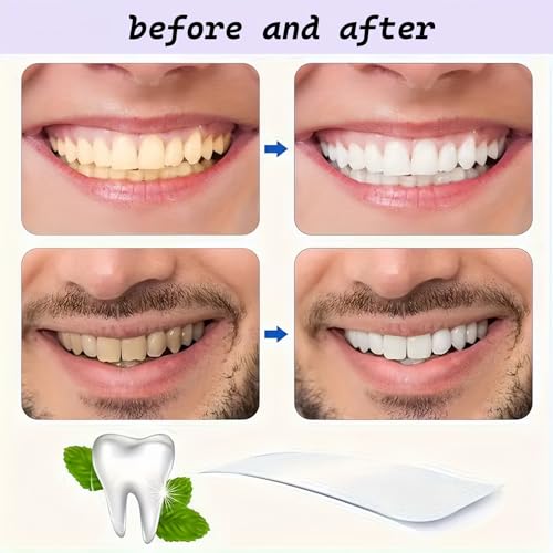 7PCS Professional Teeth Whitening Strips, Purple Whitening Strips, Non-Sensitive Whitening Patches with Color Correction Technology, Gentle Toothpaste Tablets Alternative for Effective Teeth Whitener