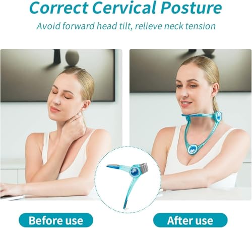Image of TORIOX Adjustable Brace - Cervical Collar with Neck Stretcher | Orthotics for Head Posture Correction and Cervical Spine Support for Pain