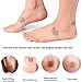 Moleskin Adhesive Pads, 10 Sheets Pre-Cut Flannel Adhesive Pad Anti-wear Heel Stickers Blister Prevention Pad for Protect Callus Blister from Rubbing on Shoes, Reduce Toe Hand Sore Spots Friction Pain
