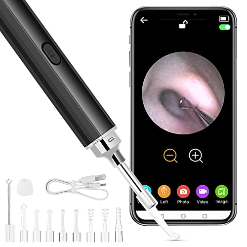 Ear Wax Removal Tool,Prime Earwax Remover with 10 pcs Ear Set for Adults and Kids,Earwax Removal kit with 1080P Waterproof Camera for iPhone,iPad,Android Phones (Black)