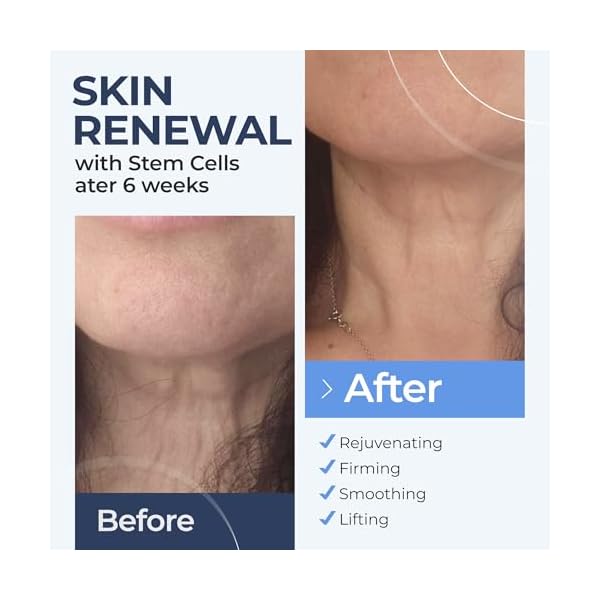 InstaSkincare Collagen Face Moisturizer with Airless Pump - Collagen Botanical Stem Cells Cream for Skin with Retinol, Niacinamide, Hyaluronic Acid - Anti-Aging Day & Night Cream - Made in USA (1.7Oz)