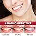 SP-6 Probiotics Whitening Toothpaste, with Probiotics Deep Cleaning Oral Care Removing Teeth Stain & Retain Fresh Breath.