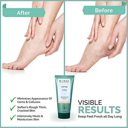 Moraz Herbal Foot Cream For Dry Cracked Heels Suitable For Everyone From Toddlers To Adults | Best Foot Cream For Rough & Calloused Feet Treatment | Moisturizing With Delightful Scent | 3.4 Fl. Oz #TOP6