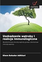 Uszkodzenie wątroby i reakcja immunologiczna 6203169714 Book Cover