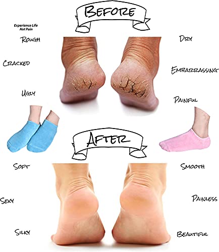 Moisturizing Socks, Gel Socks Soft Moisturizing Gel Socks, Gel Spa Socks For Repairing And Softening Dry Cracked Feet Skins, Gel Lining Infused With Essential Oils And Vitamins (Blue&Pink) #TOP2
