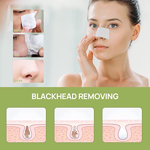 Lanbena Puntos Negros, Blackhead Mask Pore Strips, Deep Cleansing For All Skin Types thumb #2