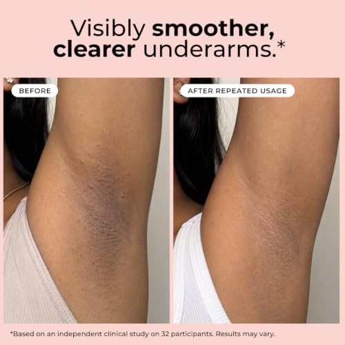 Image of Hula Hoop Underarm Roll On | Smoothens & Brightens Underarms | Niacinamide & Salicylic Acid | 48 Hr Odour Control | 0% Alcohol & Aluminium Free, Floral Fragrance | 40ml