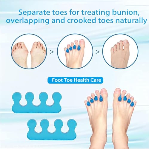 Image of Toe Separator for Feet Toe Spacers Correct Toes Yoga Silicone Hammer Toe Corrector for Women & Men Correct Toe Straighteners for Overlapping Toes (All Finger Toe Separator) (BLUE)