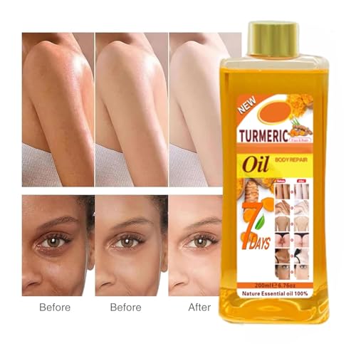 Kurkumaöl, Turmeric Body Oil, Kurkuma Körperöl, Anti Aging Hautpflege Glow Oil für Gesicht und Körper, Kurkuma Öl für Feuchtigkeit, Strafft die Haut, Reduziert feine Linien (200ml, Kurkuma)