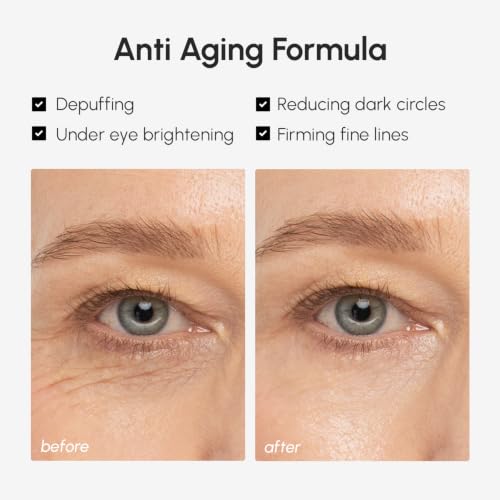 MAREE Under Eye Balm Stick Hydrating – Retinol Caffeine Under Eye Brightener Stick for Older Women – Collagen Undereye Cream for Dark Circles & Wrinkles – 0.28 Ounce, Blue - Image 4