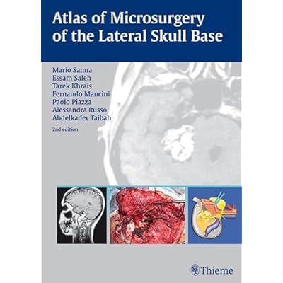 Atlas of Microsurgery of the Lateral Skull Base