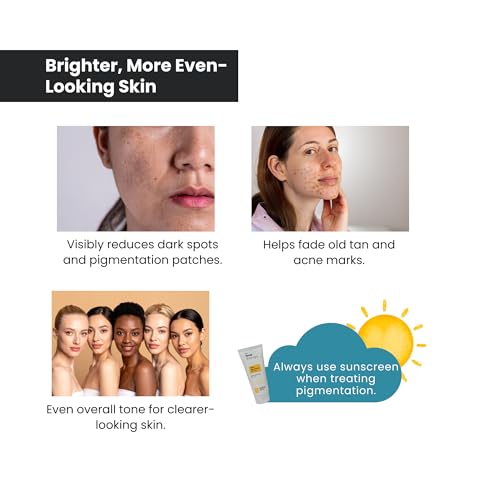 Image of The True Therapy 2% Alpha Arbutin Serum - Helps Reduce Pigmentation, Dark Spots, Blemishes, Acne Marks & Tanning - Citrus Limon Extract - 30 ml
