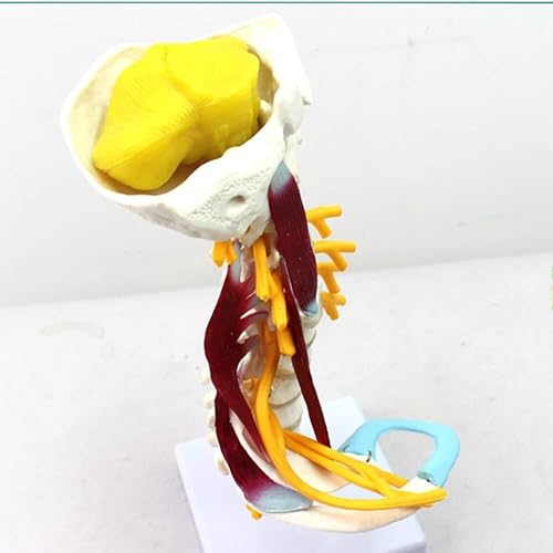 Modèle d'araignée cervicale AMITD dans votre cabinet pour expliquer l'anatomie