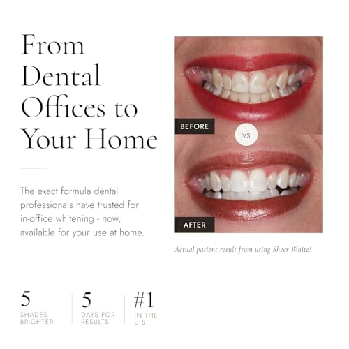 Image of Sheer White! Teeth Whitening Strips - Professional Strength Formula Whitens Up to 5 Shades in 5 Days, Invisible No Slip Strips Mold to Teeth, Enamel Safe Formula, Whiten Anytime - Anywhere!