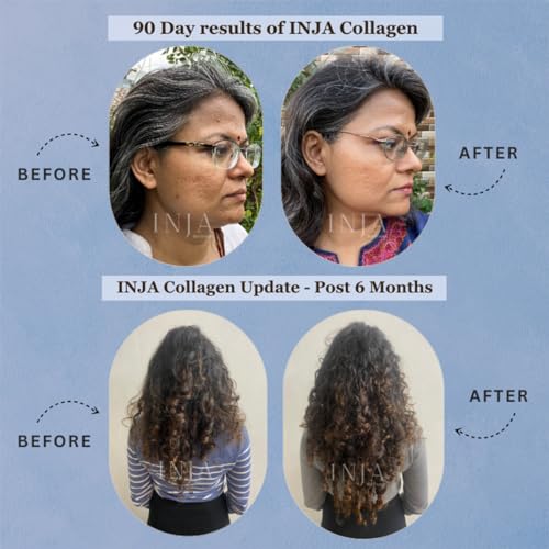 INJA Wellness Life Marine Collagen Supplement For Women, Men, Original Japanese Collagen And Formulation,Healthy Skin And Joints, Hair Growth, No Added Sugar, Blueberry Flavor,... - Image 5