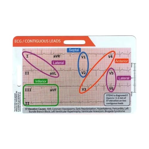QUXVUIS Tarjeta de bolsillo de ECG del Reino Unido, rica en información, referencia rápida, portátil y duradera. Tarjeta ECG acrílico del Reino Unido para cualquier lugar, B