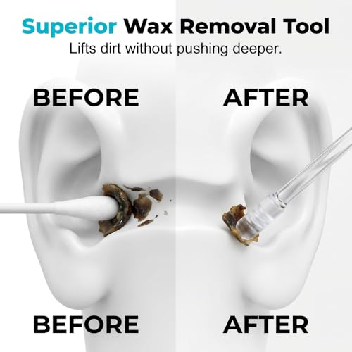 Image of Reusable Sticky Ear Cleaning Stick Ear Wax Removal Tool (3 Set-72 Pcs)