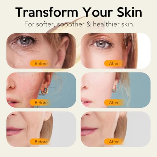 Juory Beef Tallow for Skin, Non-Greasy Tallow Balm for All Skin Types, Tallow and Honey Balm with Natural Formula, Hydrating Face Moisturizer with Calendula, Tea Tree Oil and VitaminE - Image 6