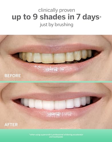Supersmile 2130-A6 Extra White Professional Teeth Whitening Toothpaste thumb #2