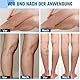 30ml Timilk VeinGuard Kräuterspray, 2pcs Krampfadern-beruhigendes Spray, Veinhealing Krampfadern Spray, Natürliches Kräuterspray for Legs, Verbessern Sie das Aussehen der Beine
