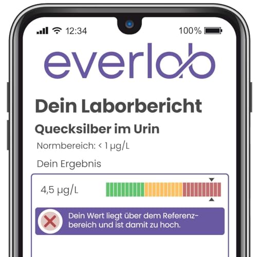Schwermetalle Test mittels Urinprobe