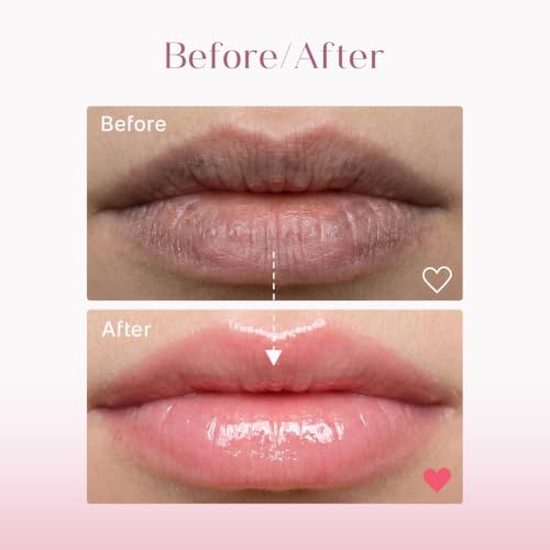 Image of Seoulskin Lip Balm SPF 50 PA++ | Brightening Lip Care for Pigmented Lips | Tinted Hydrating Formula | Kojic Acid & Niacinamide | Non-Sticky | Sun Protection | For Women | 10g