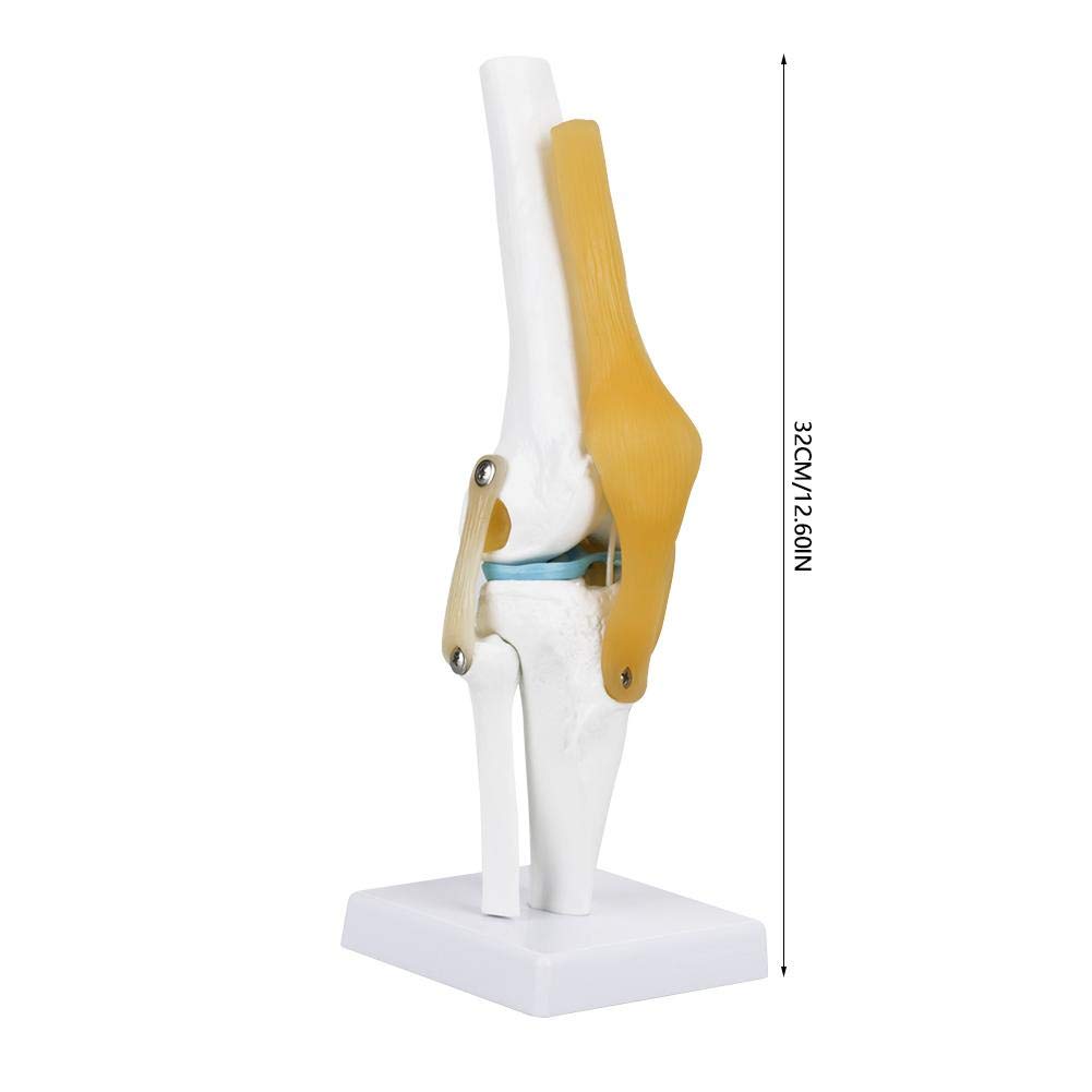 Skelett Anatomie Lebensgroß Anatomisches Kniegelenk Mit Bändern Modell,32CM Skelett Anatomie Wirbelsäule Knochenmodell Medizinisches Kniegelenk Osteoporose Anatomisches Modell Für Hobbyisten