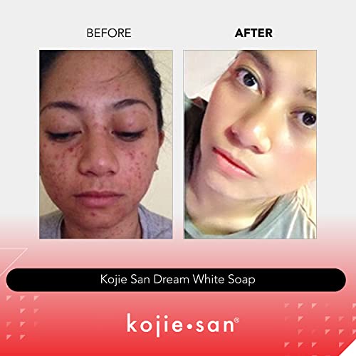 Kojie San WEED 04 Dream White Soap - Skin thumb #2
