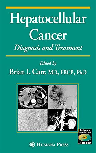 Buy Hepatocellular Cancer: Diagnosis and Treatment (Current Clinical Oncology) — BookShops.in
