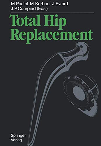 Total Hip Replacement view 2