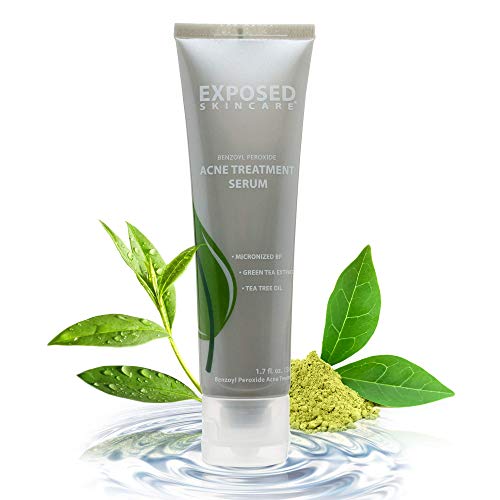 Exposed Skin Care Acne Treatment Serum Step 3 – Quickly Reduces Pimple Size and Redness - 12 Hour Spot Treatment - 3.5% Benzoyl Peroxide, Natural Green Tea & Tea Tree Oil