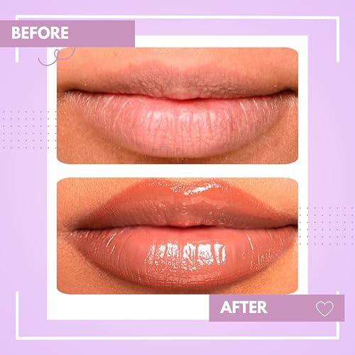 Image of TEE ESS Unisex Chocolate Lip Balm | Hydrating & Plumping Lip Care with Vitamin E, Shea Butter, Jojoba Oil | 4 gms