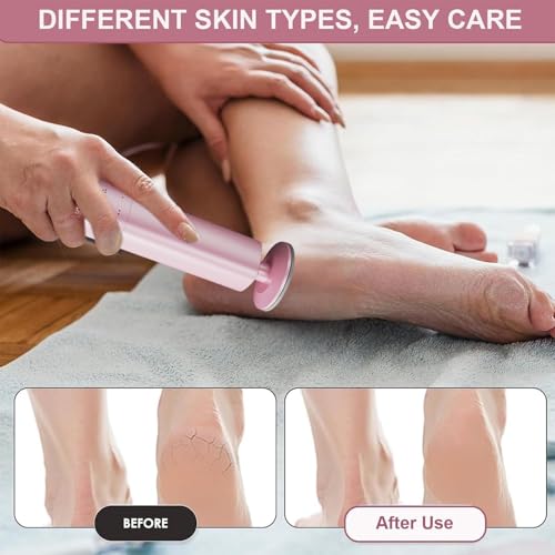 Soin des pieds nomade avec notre appareil anti-callosités électrique pour vos voyages