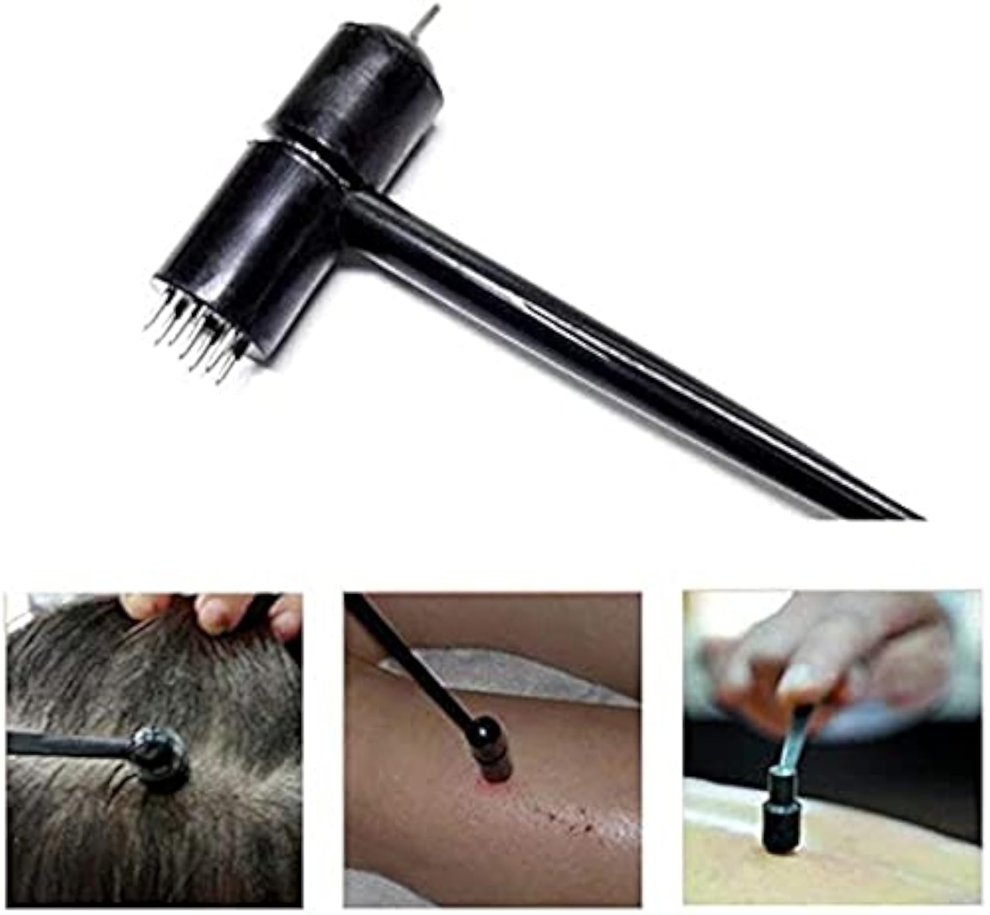 ANCS Acupuncture 7 Star Special Needles for Diabetic Care