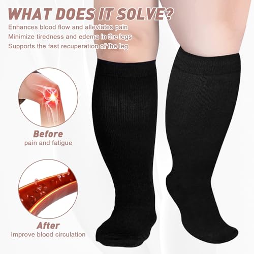 Image of Compression Socks for Women & Men Circulation 20-30mmHg Plus Size Wide Calf Knee High Compression Closed Toe Socks