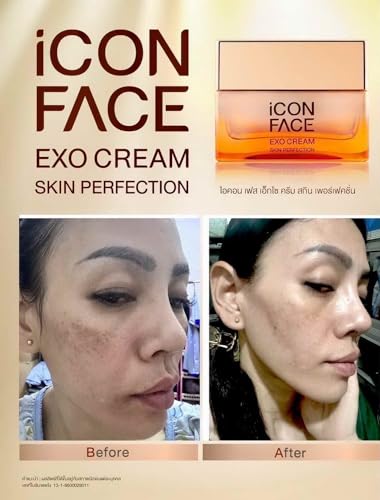 ICON-FACE-EXO-CREAM-SKIN-PERFECTION-WITH-STEM-CELLS-AND-SALMON-OVUM-EXTRACT-ANTI-AGING-CREAM-WRINKLE-Reduce-Wrinkle-Dark-Circle-Dry-Skins-Multi-Nutrients-Vitamin-B3-B5-C-50-ml