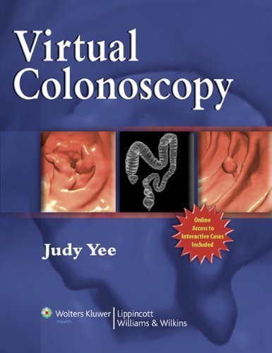Virtual Colonoscopy by Judy Yee MD (2007-10-08)