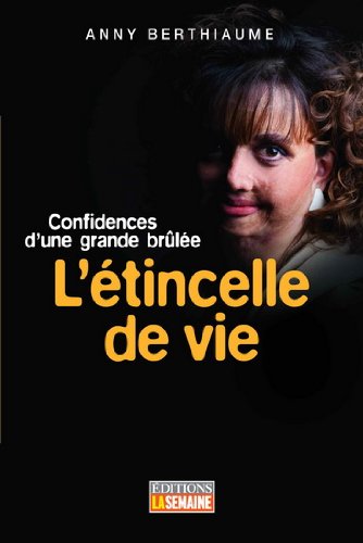 L'étincelle de vie: Confidences d'une grande brûlée [Paperback] Berthiaume, Anny