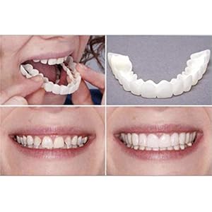 URFEDA Magic Teeth Smile Perfect Snap Veneers, tijdelijke cosmetische tandafdekking, onmiddellijke tandenreparatieset, siliconen thermische fitting, parels voor ontbrekende tanden, 1 paar