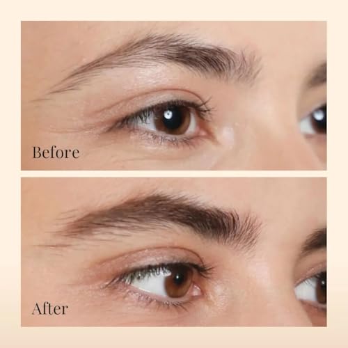 Image of Ras Luxury Oils Lash-ious Lash & Brow Growth Oil /Serum with Biotin & Hyaluronic Acid | Natural, Nourishing Formula for Fuller, Thicker, Healthier Eye Lashes & Brows | Safe for Sensitive Eyes, 8ml