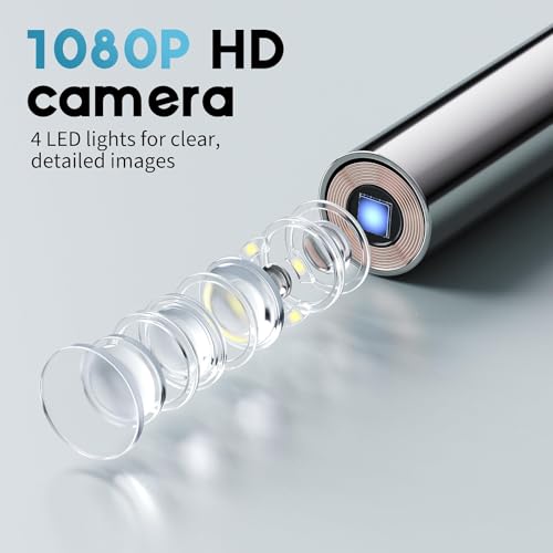Image of 1080P HD Otoscope Ear Camera for Family, Medical Grade 1.38 inch Screen, Telemedicine Ready, 12 Silicone Tips, Photo /Video, Type-C Charging, Home Medical(Blue)