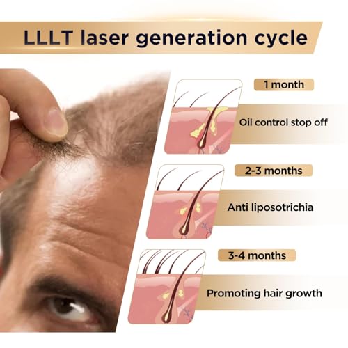 Image of Laser Hair Cap 650nm Laser Therapy for Male and Female to Promote Hair Growth Laser Hair Growth Cap for Alopecia