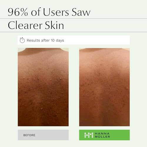 Tea Tree Body Wash, Natural Body Wash With 5% Australian Tea Tree Oil & Aloe Vera for Clean Hydrated Skin - Image 2