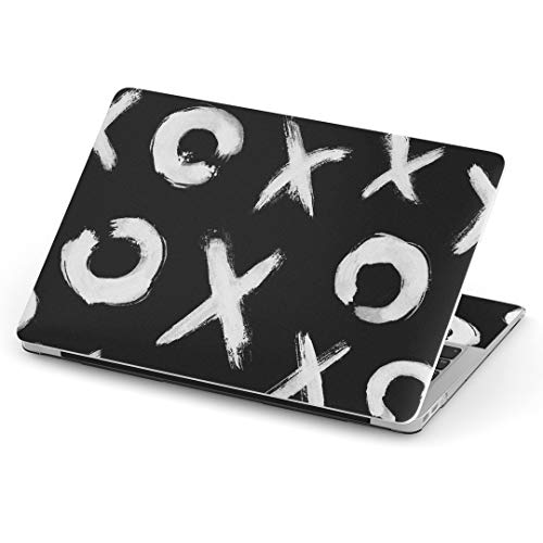 igsticker MacBook Air 13inch 2018 2019 2020 f / A1932 pXLV[ }bNubN GA Mac 13" C` Retina pV[ tB XebJ[ ANZT[ ی (2010N 