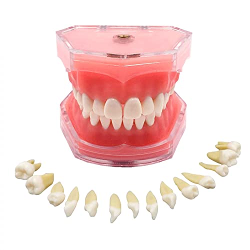 Standard Dental Demonstration, YOUYA DENTAL Teeth Model Teaching Model Study Tool Soft Gums Teaching Dental Mode with 28 Removable Teeth