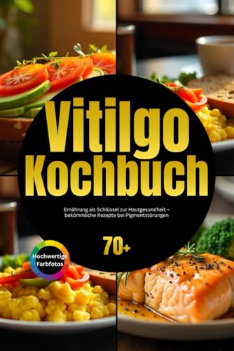 Vitilgo Kochbuch: Ernährung als Schlüssel zur Hautgesundheit – bekömmliche Rezepte bei Pigmentstörungen